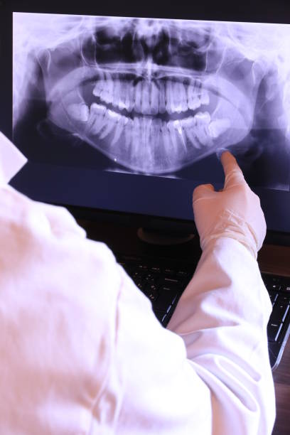 Best Emergency Wisdom Teeth Removal in Stansberry Lake, WA